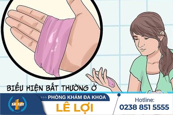Biểu hiện bất thường ở dịch âm đạo cho biết bệnh phụ khoa gì?